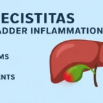 Cholecistitas: Gallbladder Inflammation, Causes, and Care 2025 cholecistitas-gallbladder-inflammation-causes-and-care-2025