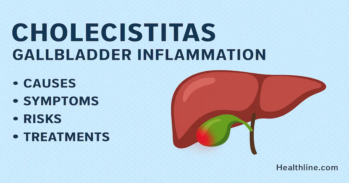 cholecistitas-gallbladder-inflammation-causes-and-care-2025